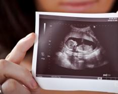 Ushqyerja për një grua shtatzënë në tremujorin e dytë Çfarë mund të bëjnë gratë shtatzëna në tremujorin e dytë?
